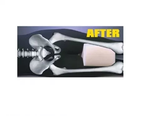 Viskoelastinė pagalvė kojoms, 25 x 20 x 15 cm