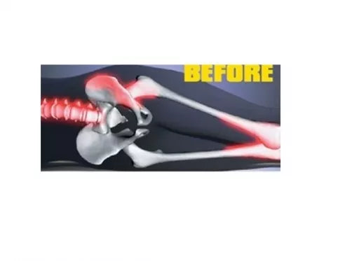 Viskoelastinė pagalvė kojoms, 25 x 20 x 15 cm